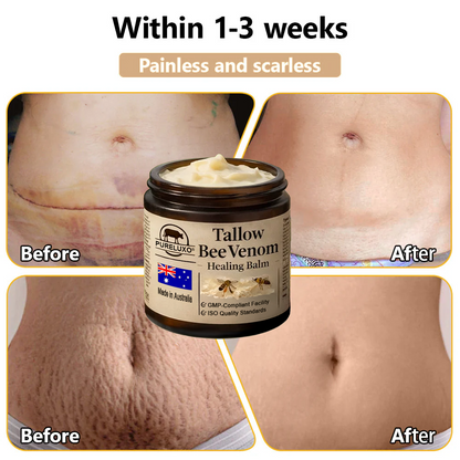 【70% OFF Wraps Up Today】Pureluxo® 🐄Tallow Bee Venom Healing Balm（Sorts Out Spots, Wrinkles & Knackered Skin — Steroid-Free）