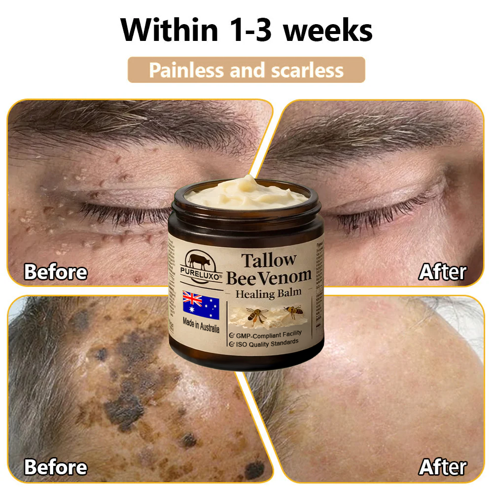 【70% OFF Wraps Up Today】Pureluxo® 🐄Tallow Bee Venom Healing Balm（Sorts Out Spots, Wrinkles & Knackered Skin — Steroid-Free）
