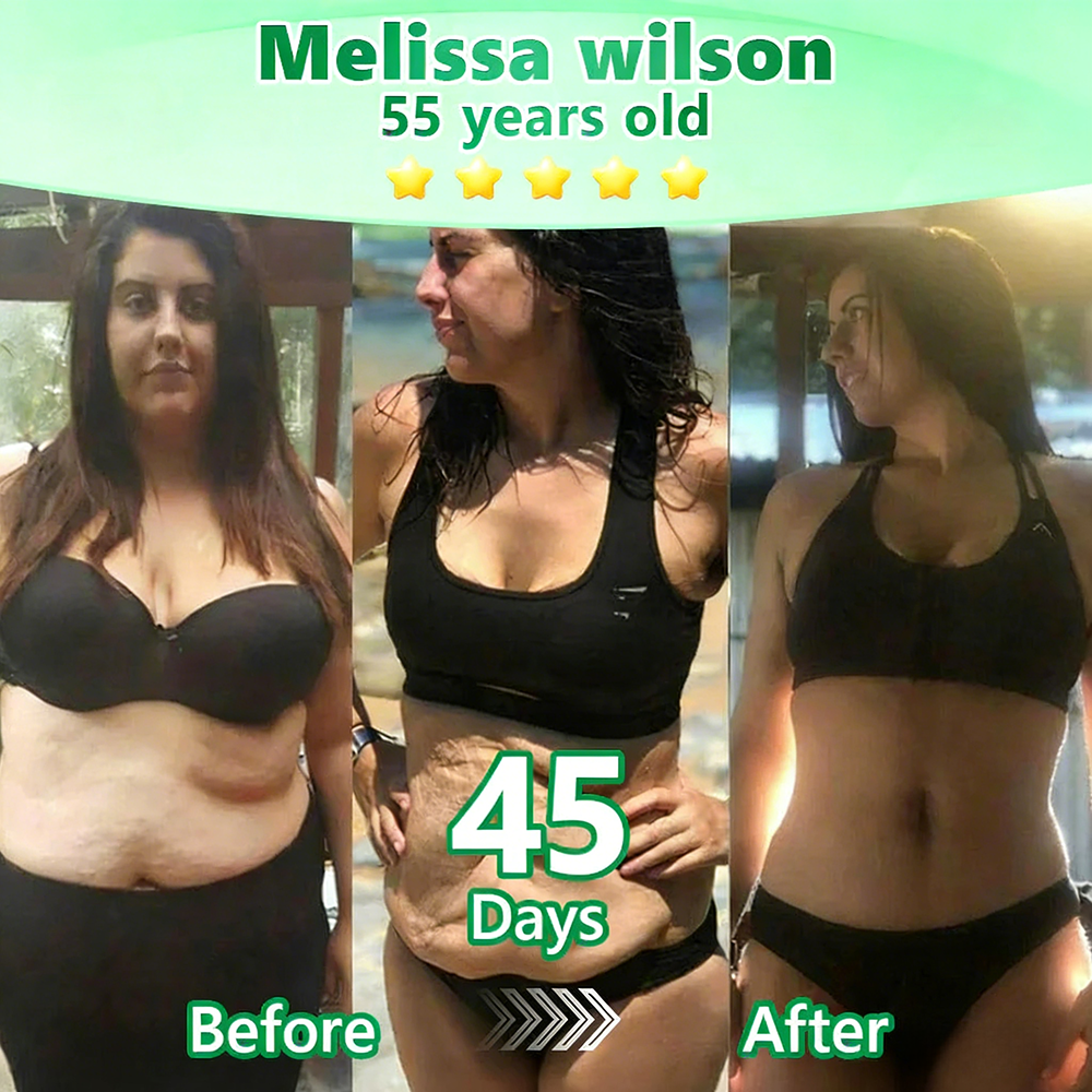 【🇦🇺𝐿𝑎𝑠𝑡 𝐷𝑎𝑦 𝑃𝑟𝑜𝑚𝑜𝑡𝑖𝑜𝑛 70% 𝑂𝐹𝐹】|𝙋𝙪𝙧𝙚𝙡𝙪𝙭𝙤® 𝑴𝒐𝒓𝒊𝒏𝒈𝒂 & 𝑩𝒆𝒓𝒃𝒆𝒓𝒊𝒏𝒆 *NAD+| Slimming & Firming 2-in-1 Nano Microneedle Patch|𝘉𝘢𝘤𝘬𝘦𝘥 𝘣𝘺 𝘴𝘤𝘪𝘦𝘯𝘤𝘦 | 10-𝗂𝗇-𝟣 𝖿𝗈𝗋𝗆𝗎𝗅𝖺 | 𝑅𝑒𝑠𝑢𝑙𝑡𝑠 𝑖𝑛 7 𝑑𝑎𝑦𝑠 ⏳