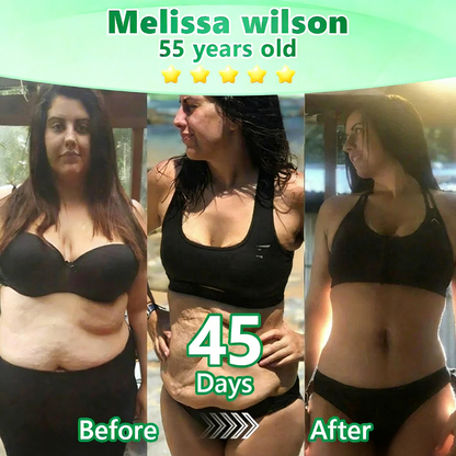 【🇦🇺𝐿𝑎𝑠𝑡 𝐷𝑎𝑦 𝑃𝑟𝑜𝑚𝑜𝑡𝑖𝑜𝑛 70% 𝑂𝐹𝐹】|𝙋𝙪𝙧𝙚𝙡𝙪𝙭𝙤® 𝑴𝒐𝒓𝒊𝒏𝒈𝒂 & 𝑩𝒆𝒓𝒃𝒆𝒓𝒊𝒏𝒆 *NAD+| Slimming & Firming 2-in-1 Nano Microneedle Patch|𝘉𝘢𝘤𝘬𝘦𝘥 𝘣𝘺 𝘴𝘤𝘪𝘦𝘯𝘤𝘦 | 10-𝗂𝗇-𝟣 𝖿𝗈𝗋𝗆𝗎𝗅𝖺 | 𝑅𝑒𝑠𝑢𝑙𝑡𝑠 𝑖𝑛 7 𝑑𝑎𝑦𝑠 ⏳