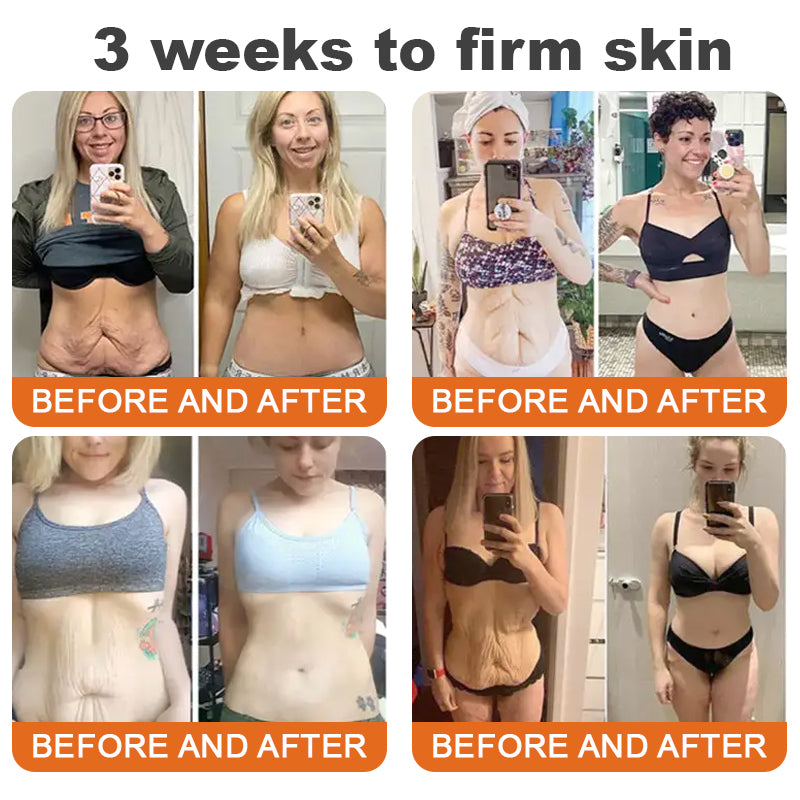 Made and Shipped from USA✨ TLOPA® Botox Bee Venom Firming Serum Stick(🔥LAST DAY 70% OFF)💄