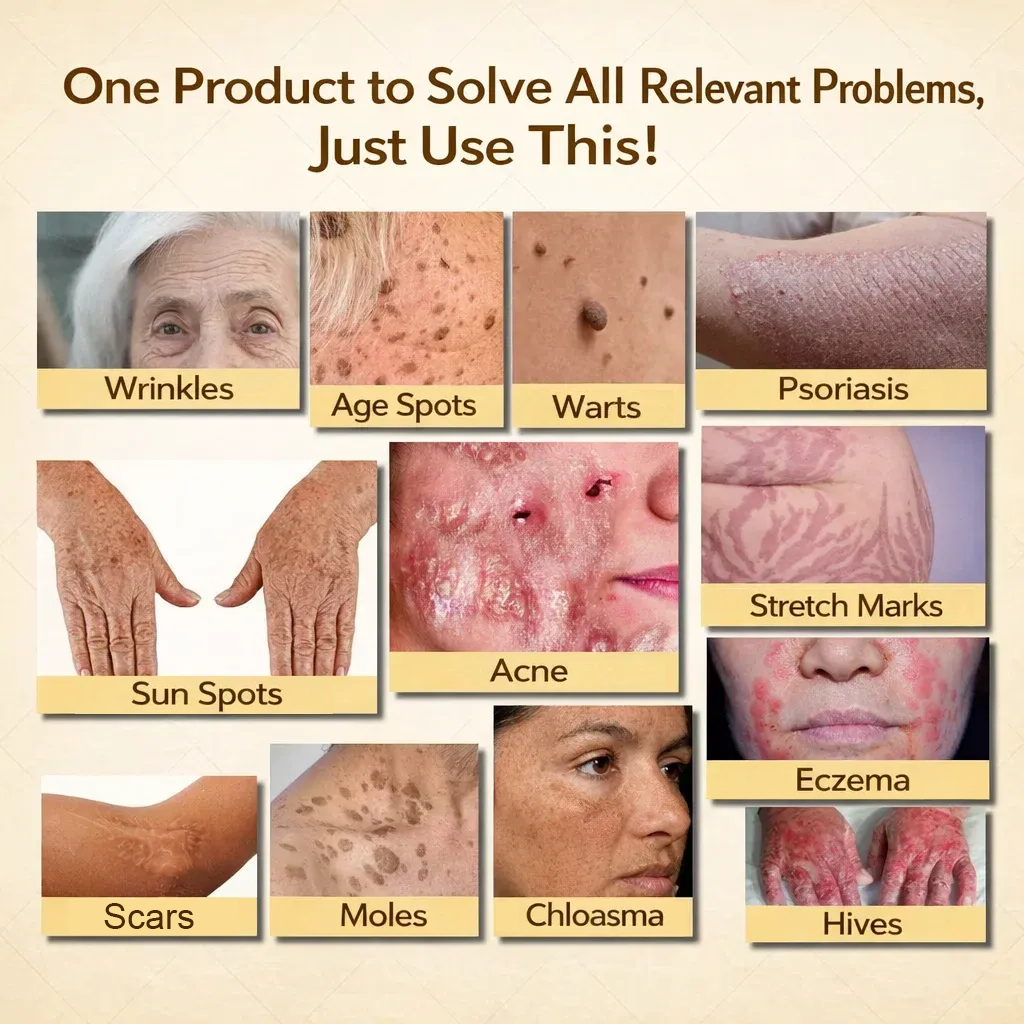 【70% OFF Wraps Up Today】Pureluxo® 🐄Tallow Bee Venom Healing Balm（Sorts Out Spots, Wrinkles & Knackered Skin — Steroid-Free）