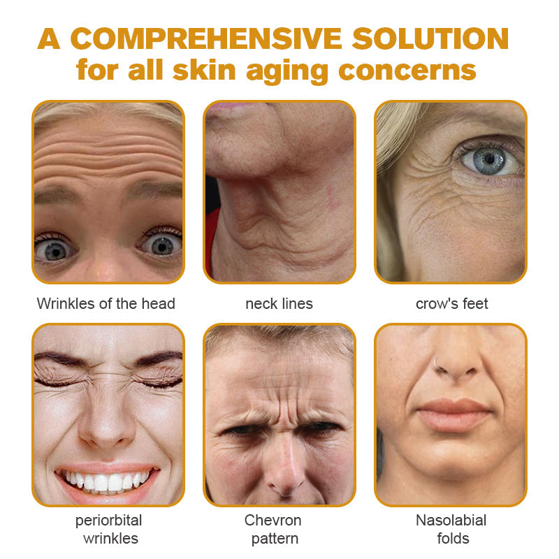 (Made and Shipped from USA) 🧑‍⚕️ TLOPA® Botox Bee Venom Wrinkle Removal Cream- LAST DAY 70% OFF🔥