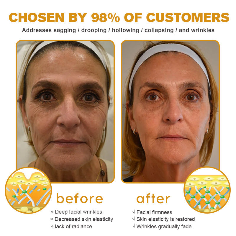 (Made and Shipped from USA) 🧑‍⚕️ TLOPA® Botox Bee Venom Wrinkle Removal Cream- LAST DAY 70% OFF🔥